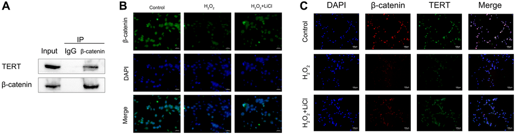 LiCl reverses the H2O2-induced reduction in the nuclear translocation of β-catenin and the interaction between β-catenin and TERT in BMSCs. (A) Co-IP showing β-catenin binding to TERT in BMSCs. (B) Immunofluorescence staining reveals nuclear translocation of β-catenin in BMSCs treated with H2O2 or LiCl. (C) Immunofluorescence assays were performed to identify colocalization between β-catenin and TERT in BMSCs treated with H2O2 or LiCl. All results were performed as mean ± SD. #P *P 2O2 group, n = 6. Scale bar: 100 μm.