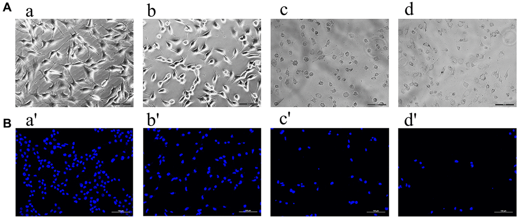 The ((A) a–d) showed the results observed under the inverted microscope after being treated by different concentrations of formononetin for 48 h. Meanwhile, ((B) a′–d′) showed the results treated with DAPI for 48 h to assess cell apoptosis. (a, a′) The MG63 cells were treated with 0μg/mL Form for 48 h (the control group). (b, b′) The MG63 cells were treated with 5 μg/mL Form for 48 h. (c, c′) The MG63 cells were treated with 8 μg/mL Form for 48 h. (d, d′) The MG63 cells were treated with 10 μg/mL Form for 48 h.