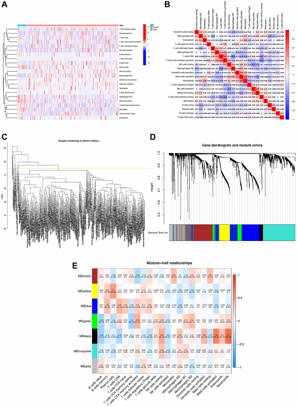 Immune cell correlation analysis and weighted gene co-expression network analysis (WGCNA). (A) Correlation analysis of immune cell populations in normal and tumor samples, with negative correlations in blue and positive correlations in red. (B) Detailed immune cell correlation analysis. (C) Sample clustering to detect groups with more than 75 samples. (D) WGCNA co-expression analysis showing which module each gene belongs to. (E) Clinical correlation analysis of each module to observe the correlation between modules and immune cells, with blue representing negative correlation and red representing positive correlation.