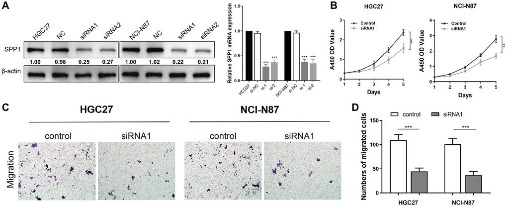 Down-regulation of SPP1 inhibits proliferation and migration abilities of HGC27 and NCI-N87 cells. (A) Compared with the negative control group in HGC27 and NCI-N87 cells, SPP1 in siRNA transfection group was down-regulated in protein and mRNA expression levels. (B) Compared with the control group, the down-regulation of SPP1 significantly inhibited the proliferation of STAD cells. (C, D) Downregulation of SPP1 expression can significantly inhibit the metastatic ability of gastric cancer cells. ***p **p 