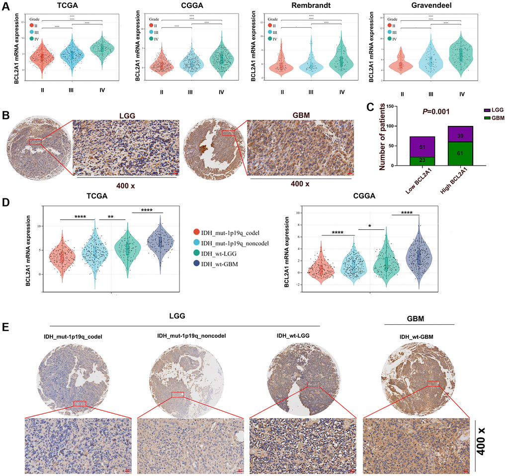 BCL2A1 was associated with the malignancy of gliomas. (A) TCGA, CGGA, Rembrandt and Gravendeel datasets were utilized to assess the expression of BCL2A1 in tumors of different grades. (B, C) IHC staining of BCL2A1 in LGG and GBM tissues. (D) BCL2A1 expression in gliomas with different IDH and 1p19q statuses in TCGA and CGGA datasets. (E) The expression of BCL2A1 in gliomas with different IDH and 1p19q statuses was analyzed by immunohistochemistry. Abbreviations: mut: mutation; WT: wild type; codel: codeletion; non-codel: non-codeletion. *P **P ***P ****P 