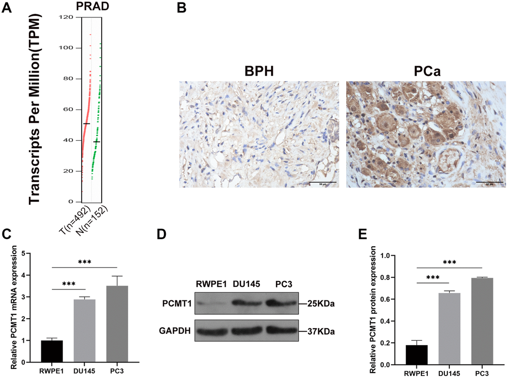 Expression of PCMT1 in PCa tissues and cell lines. (A) The expression of PCMT1 was identified in 492 PCa and 152 normal prostate tissues from TCGA and GTEx data. (B) PCMT1 protein expression in BPH and PCa tissues (IHC, ×400). (C) PCMT1 mRNA expression in PCa cell lines and the prostate epithelial cell line. (D) PCMT1 protein expression in PCa cell lines and normal prostate epithelial cell line. (E) Quantitative analysis of PCMT1 protein expression. Data are expressed as mean ± SD of at least three experiments. *P ***P 