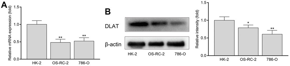 The mRNA and protein expression of DLAT in HK-2, OS-RC-2 and 786-O cells. (A) DLAT mRNA expression. (B) DLAT protein expression.
