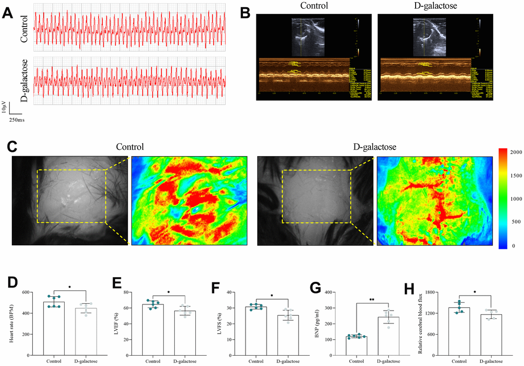 D-galactose decreased SAN and heart function in mice. (A) Electrocardiogram. (B) Echocardiogram. (C) Cerebral blood flux. (D) Heart rate in the indicated groups. (E, F) LVEF and LVFS in the indicated groups. (G) BNP assay results for the indicated groups. (H) Cerebral blood flux results for the indicated groups. * represents PP