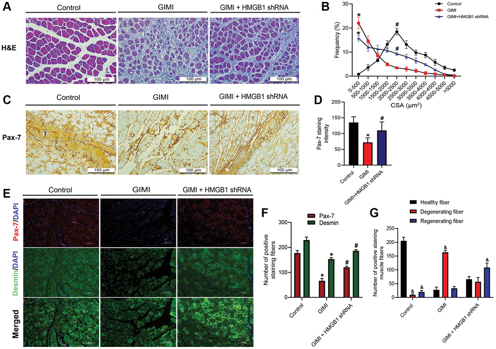 Inhibition of HMGB1 reverses glycerol-induced muscle injury (GIMI) and Pax-7 expression. (A) Representative images of H&E-stained tibialis anterior (TA) sections from mice in control group and glycerol-induced muscle injury (GIMI) without or with HMGB1 shRNA treated-group (GIMI+HMGB1 shRNA) (n = 3); scale bars = 100 μm. (B) Frequency distribution of cross-sectional area (CSA) of TA muscle fibers (n = 3). (C) Immunohistochemistry analysis of Pax-7 protein expression in TA muscle of control group, GIMI group, and GIMI+HMGB1 shRNA group (n = 3). (D) Quantification of Pax-7 staining intensity in TA muscle (n = 6). (E) Immunofluorescence analysis showing the expression of Pax-7 and desmin in TA muscle in the control, GIMI, and GIMI+HMGB1 shRNA groups (n = 3); scale bars = 100 μm. (F) Quantification of the Pax-7 and desmin positive staining fibers in TA muscle were analyzed by ImageJ software (n = 3). (G) The healthy fiber (large cells), degenerating fiber (mononuclear in necrotic cells), and regenerating fiber (multinucleated cells) were quantified with the positive double-staining of Pax-7 and desmin by using ImageJ software (n = 3). All data are presented as the mean ± SD of triplicate experiments. &p *p #p 