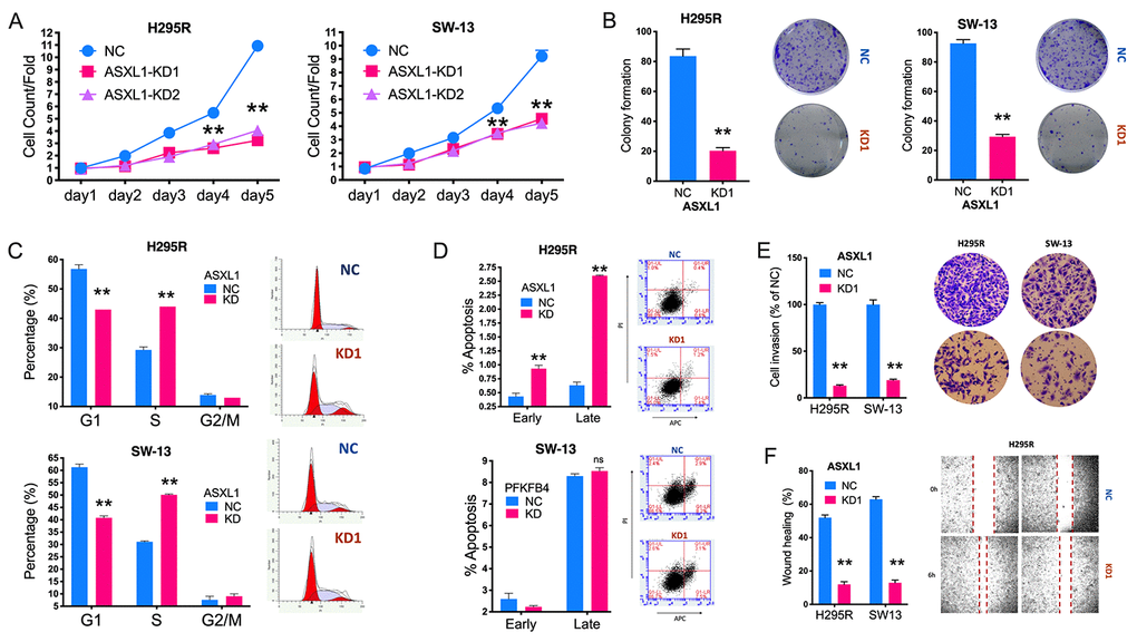 Silencing of ASXL1 decreased fitness of adrenocortical carcinoma (ACC) cells. (A) Cell count detected using CCK-8 in ACC cell lines with ASXL1-knockdown (KD) by shRNA#1 and shRNA#2 (KD1 and KD2) or negative control (NC); (B) Colony formation in ACC cell lines with ASXL1 silencing or control; Flow cytometry used to detect (C) cell cycle profile and (D) apoptosis in ACC cells with ASXL1-KD or NC; (E) Transwell assays used to detect cell invasion with Matrigel in ACC cells with ASXL1-KD or NC, captured at 100×; (F) Wound healing assay in ACC cells with ASXL1-KD or NC (**P 