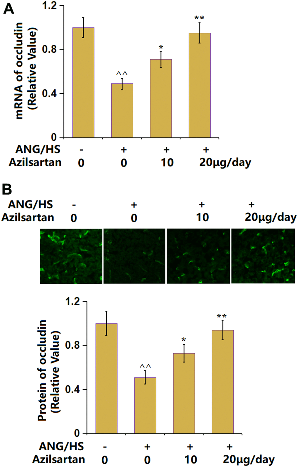 The effects of Azilsartan on the expression of occludin in renal tissues in ANG/HS-challenged mice. (A) mRNA of occludin; (B) Protein of occludin as measured by immunostaining. Scale bar, 100 μm (n=5 or 6, ^^, P