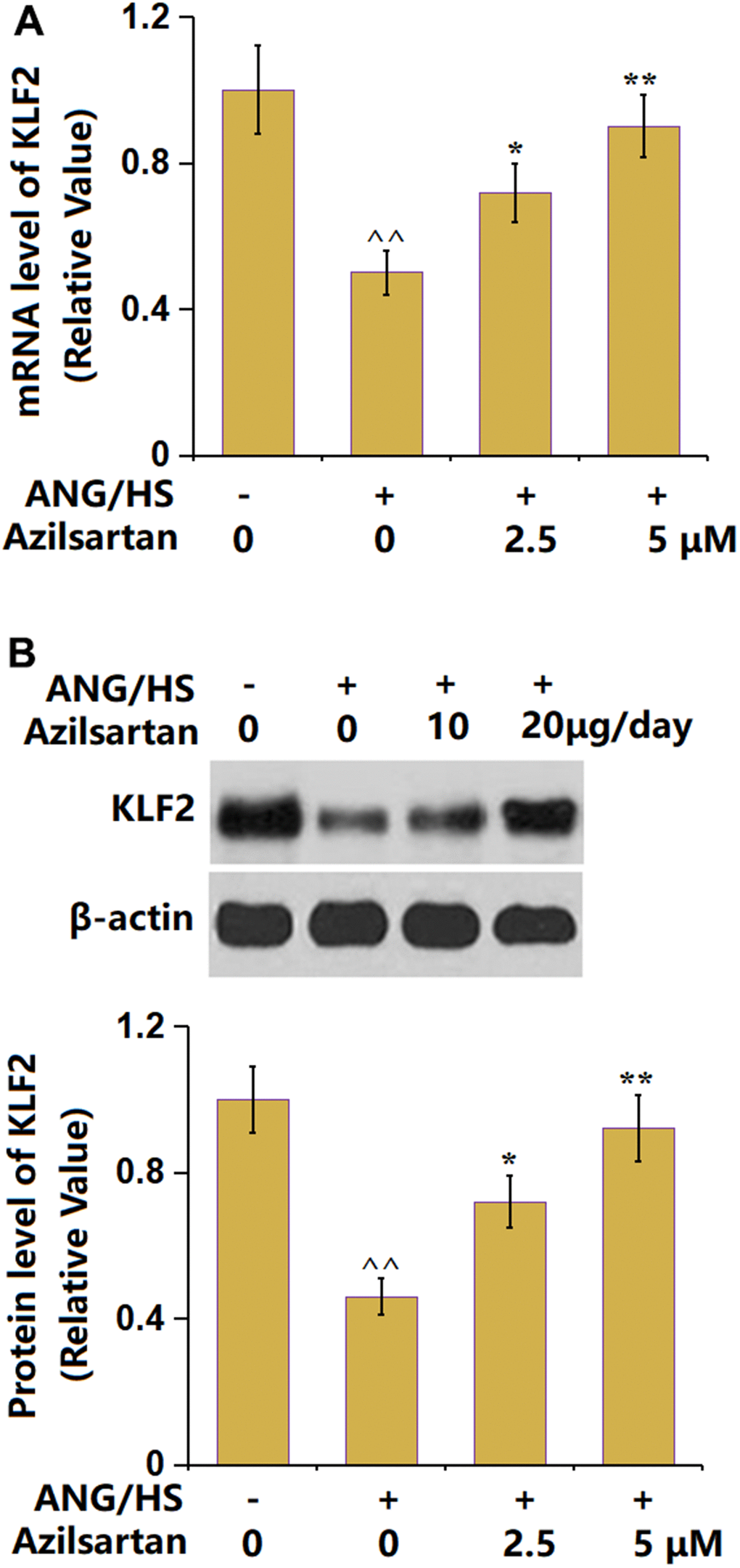 Azilsartan prevents ANG/HS-induced reduction in KLF2 in human renal glomerular endothelial cells (HrGECs). HrGEC monolayer was treated with ANG/HS with or without Azilsartan (2.5, 5 μM) for 24 hours. (A) mRNA level of KLF2; (B) Protein level of KLF2 (n=6, ^^, P