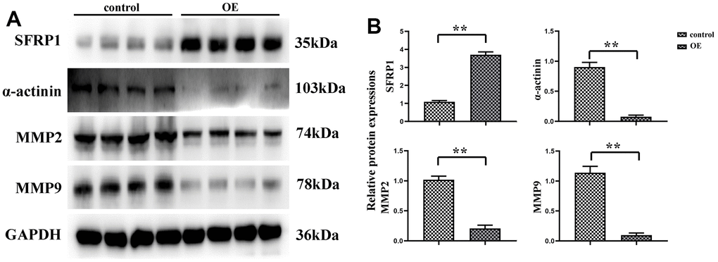 MEG3 overexpression can reduce the motility of CRC cells. (A) Protein expression bands of SFRP1, α-actinin, MMP2 and MMP9; (B) Relative protein expression of SFRP1, α-actinin, MMP2 and MMP9. **P