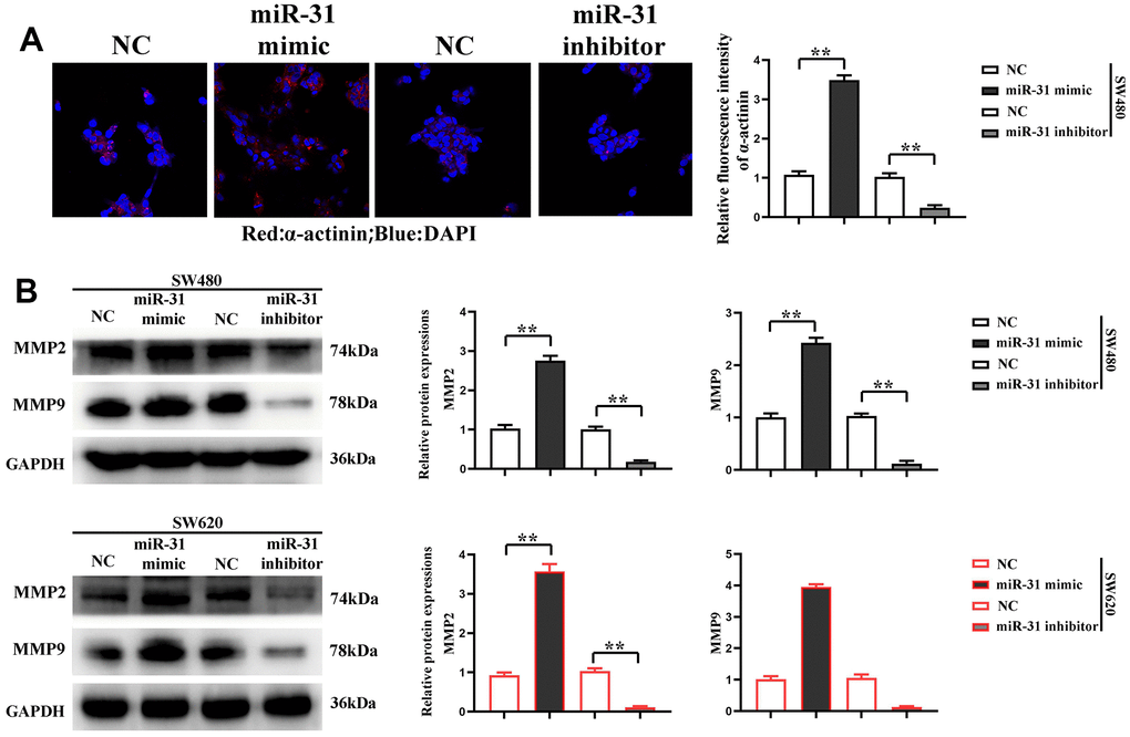 miR-31 promotes the migration of CRC cells. (A) Immunofluorescence detected the expression of α-actinin in each group of cells; (B) Western blotting detected the relative protein expression of MMP2 and MMP9. **P