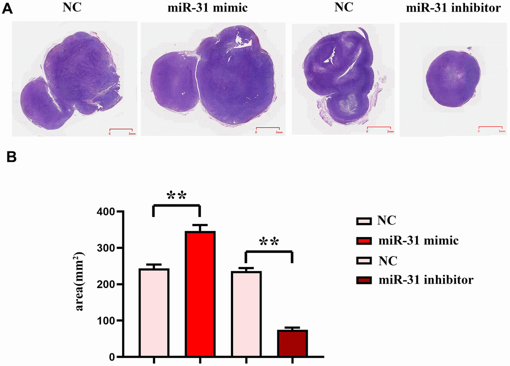 miR-31 can promote the progression of colon cancer cells. (A) Plots of HE staining results; (B) Tumor slice area statistics. **P