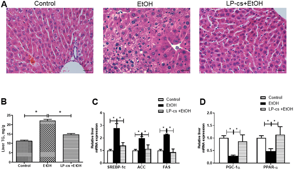 Lactobacillus plantarum ST-III culture supernatant (LP-cs) ameliorates acute alcohol-induced liver steatosis. (A) Hematoxylin and eosin (H&E) staining of livers from Control, EtOH, and LP-cs +EtOH mice (40 x: scale bars = 25 μm). (B) Liver triglyceride (TG) levels. (C) Relative liver mRNA expression of SREBP-1c, acetyl-CoA carboxylase, and fatty acid synthase. (D) Relative liver mRNA expression of PGC-1α and PPAR-α. Data are expressed as mean ± SEM. *p 