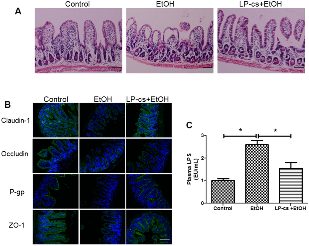 Lactobacillus plantarum ST-III culture supernatant (LP-cs) ameliorates acute alcohol-induced intestine injury. (A) Hematoxylin and eosin (H&E) staining of intestine from control, EtOH, and LP-cs +EtOH mice (20 x: scale bars = 50 μm). (B) Immunofluorescence staining of claudin-1, occludin, P-gp, and zonula occludens-1 (ZO-1) positive area of intestine from Control, EtOH and LP-cs +EtOH mice (40 x: scale bars = 25 μm). (C) Plasma LPS levels. Data are expressed as mean ± SEM. *p 