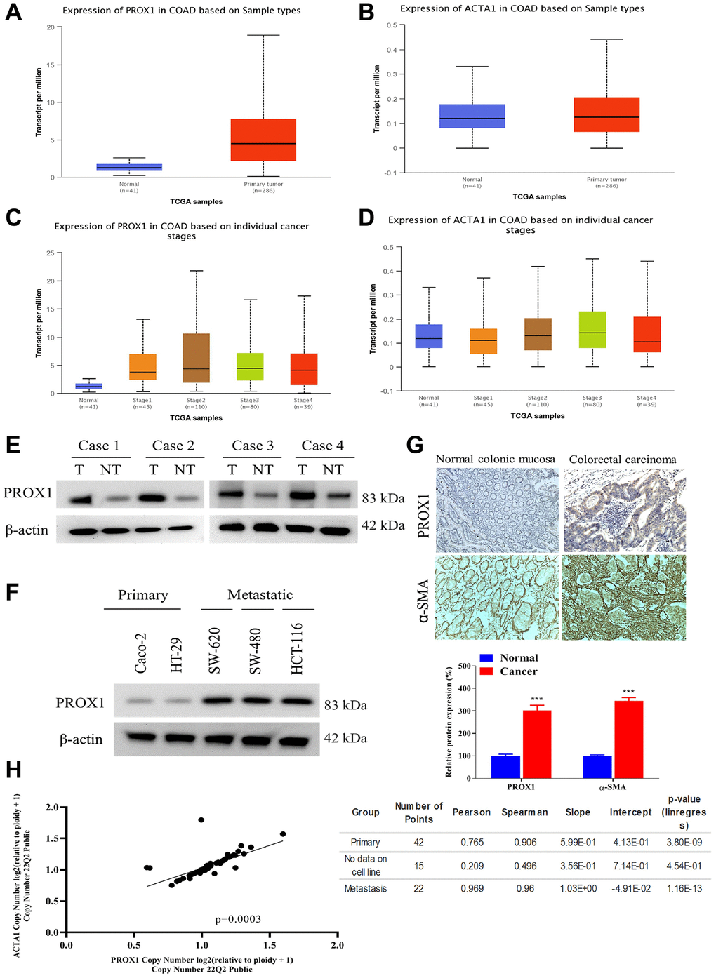 PROX1 and α-SMA overexpressed in CRC clinical samples and cell lines. (A, B) TCGA COAD dataset available from UALCAN shows, that PROX1 and α-SMA are upregulated in colorectal adenocarcinoma tissues. (C, D) PROX1 and α-SMA expression in COAD cases on the indivisible cancer stage from TCGA COAD dataset available from UALCAN. Western blot analysis of PROX1 expression in (E) paired tumor and non-tumor colorectal clinical samples and (F) human colorectal cancer cell lines, Caco-2, HT-29, SW-480, SW-620 and HCT116. β-actin is used as loading control; (G) Immunohistochemical analysis of PROX1 or α-SMA expression in normal colonic and colorectal tumor samples. (H) DepMap analysis of correlation expression of PROX1 and α-SMA.