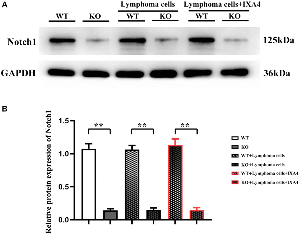 Western blotting of Notch-1. (A) Protein bands of Notch-1; (B) Relative protein expression of Notch-1. (WT group vs. KO group; WT + lymphoma cell group vs. KO + lymphoma cell group; WT + lymphoma cell + IXA4 group vs. KO + lymphoma cell + IXA4 group; **P nsP > 0.05; N = 3).