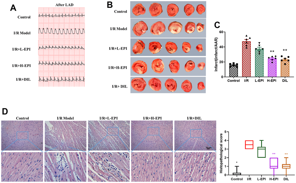 EPI alleviates myocardial ischemia-reperfusion injury in vivo. (A) Electrocardiogram of each group of rats after modeling. (B) TTC staining of cardiac tissues in each group. (C) Infarction rates of cardiac tissues in each group. (D) Effects of EPI on histopathological changes of cardiac tissues suffered from surgical procedures of ischemia-reperfusion, and histogram scores of myocardial tissue of rats in each group. I/R + L-EPI: 1 mg/kg/day of EPI; I/R + H-EPI: 2 mg/kg/day of EPI. Data (n=6) are expressed as mean ± SD, *P  compared with I/R group, **P  compared with I/R group.