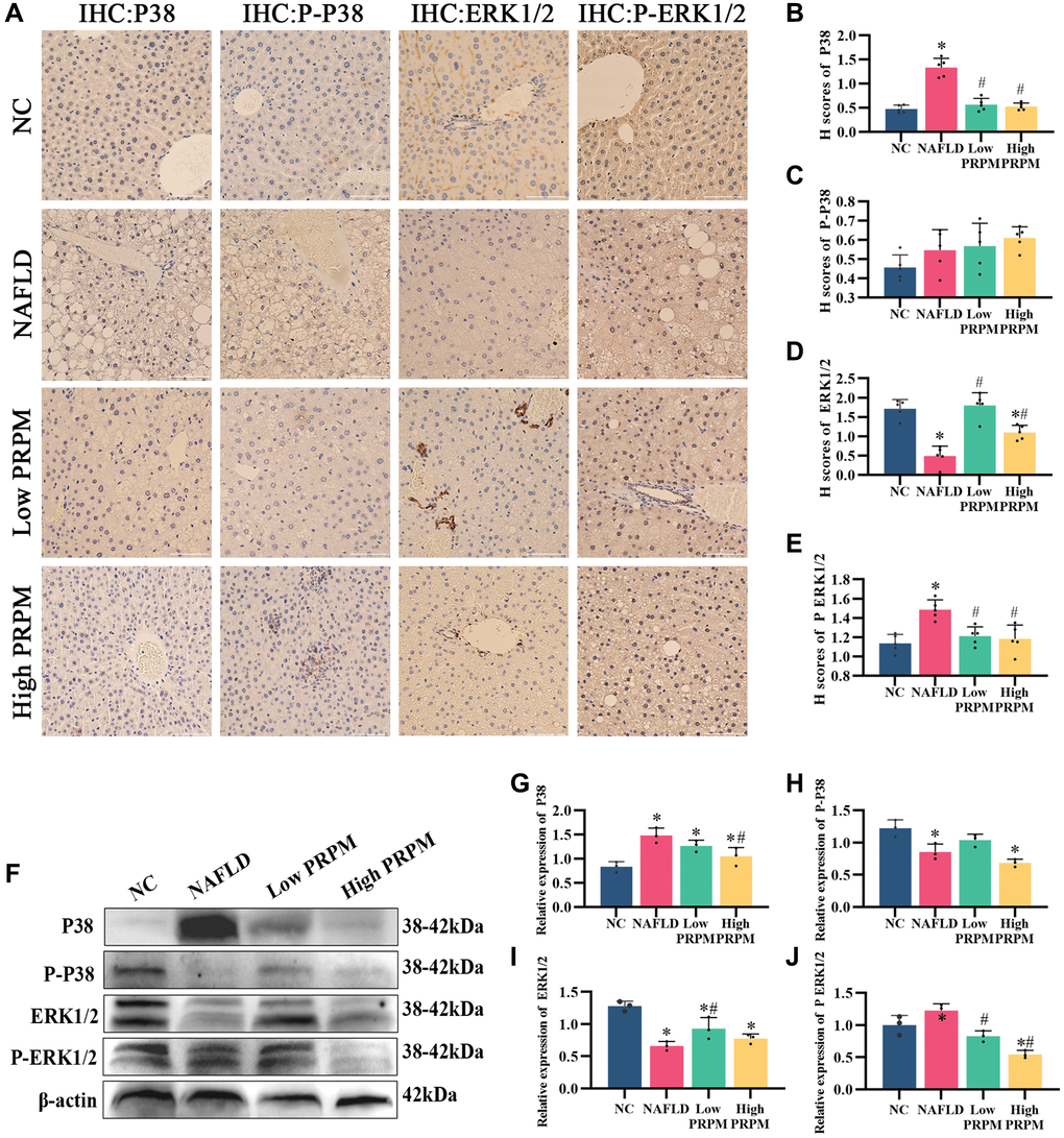 PRPM mediates the MAPK signaling pathway in NAFLD. (A) IHC staining of P38, phosphorylated P38, ERK1/2 and phosphorylated ERK1/2 in NAFLD mouse models, ×200, ×400. (B–E) Correlation analysis of H-scores of P38, phosphorylated P38, ERK1/2 and phosphorylated ERK1/2. (F) Representative Western blot of P38, phosphorylated P38, ERK1/2 and phosphorylated ERK1/2. (G–J) Western blot analysis. *indicates comparison with NC, P #indicates a comparison with NAFLD, P 