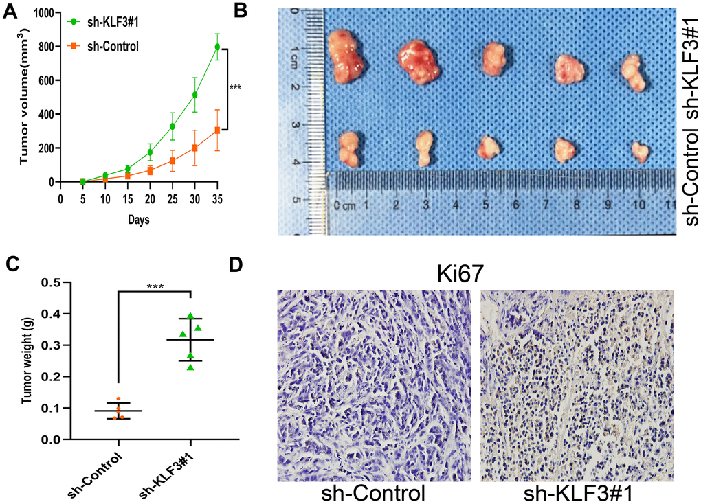 Down-regulation of KLF3 promotes CRC growth in vivo. (A–C) Representative images of HCT116-sh control or HCT116-sh-KLF3#1 subcutaneous xenograft tumor. Tumors in KLF3 knockdown mice grew faster than in controls in terms of volume and mass (N = 5/ group). (D) Ki67 level was elevated in HCT116-sh-KLF3#1 cell relative to HCT116-sh-NC cells. Scale bar: 20 μm. ***P