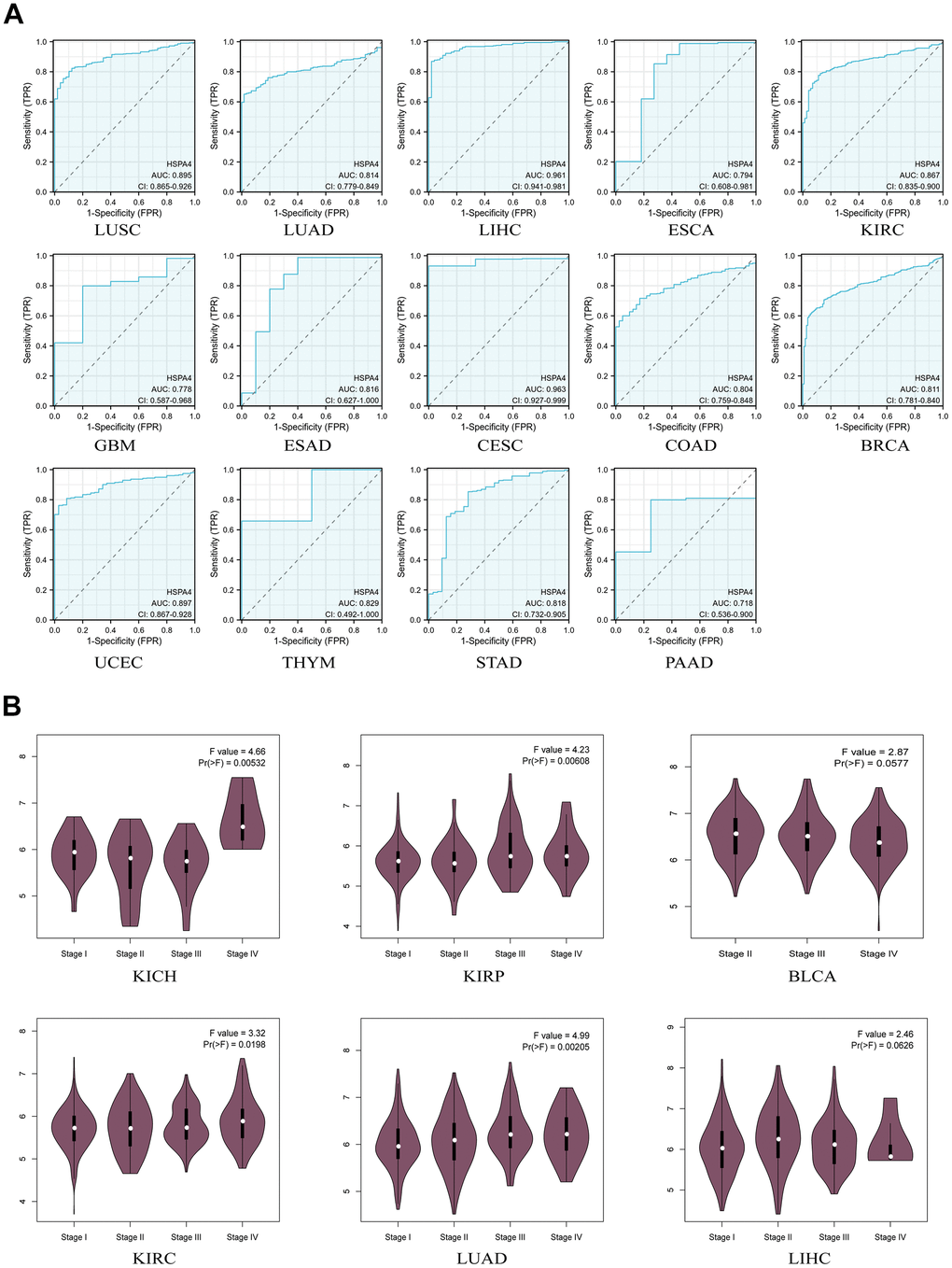 Diagnostic value of HSPA4 in pan-cancer. (A) ROC curve of HSPA4 in 14 types of cancers. (B) Based on the TCGA data, the expression levels of the HSPA4 gene were analyzed by the main pathological stages (stage I, stage II, stage III, and stage IV) of KICH, KIRP, BLCA, KIRC, LUAD, LIHC. Log2 (TPM+1) was applied for log-scale.