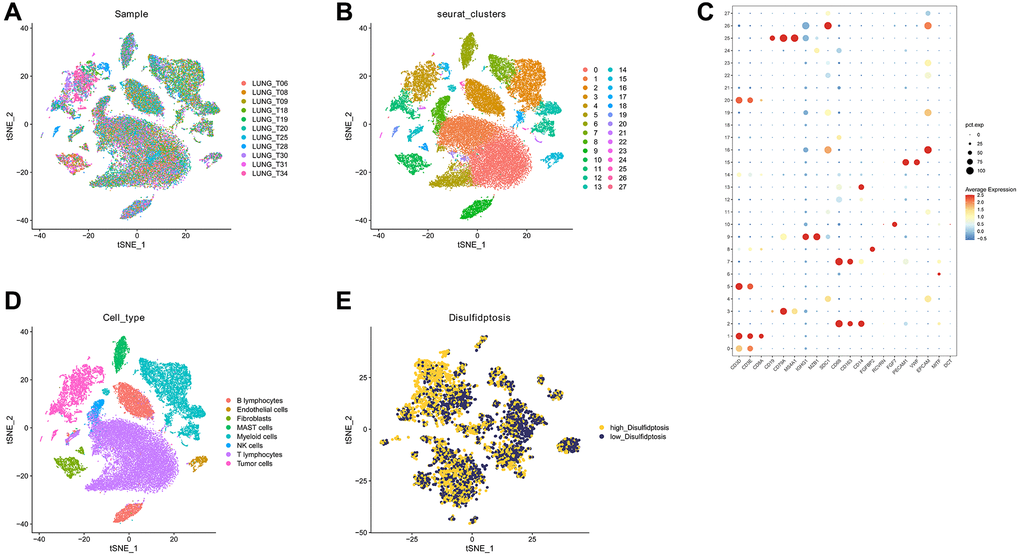 Analysis of GSE131907 using single-cell sequencing technology. (A) The 11 samples exhibit a notable level of integration efficacy. (B, C) Dimensionality reduction and cluster analysis. (D) According to the surface marker genes of different cell types, the cells are annotated as BB lymphocytes, endothelial cells, fibroblasts, MAST cells, myeloid cells, NK cells, T lymphocytes, and tumor cells, respectively. (E) The cells were divided into high- and low-disulfidptosis cells according to the percentage of DRG in each cell.