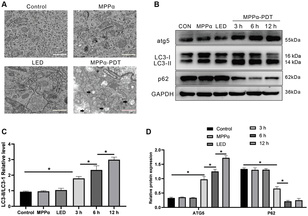 Autophagy can be triggered by MPPα-PDT. (A) Transmission electron microscopy (magnification, ×20000) was used to observe autophagosomes upon autophagy induction by MPPα-PDT after 12 h. (B–D) Cells were harvested 3, 6, and 12 h after MPPα-PDT treatment and protein ATG5, LC3-II/LC3-I, and p62 were determined by western blot. Data are shown as mean ± SD of 3 independent experiments. *P 