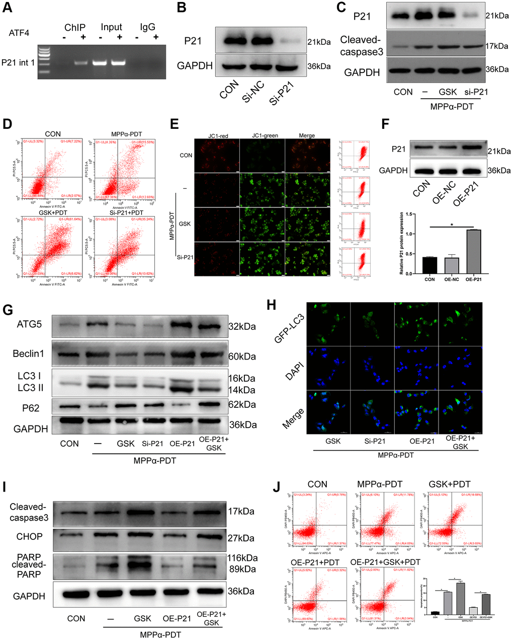 The pro-survival effect of P21 is achieved by regulating autophagy after MPPα-PDT. (A) ChIP analysis was used to detect ATF4 binding to the first intron of p21. HOS cells were transfected with siRNAs and then treated with MPPα-PDT. (B) Protein P21 were detected by western blot to represent the transfection efficiency. (C) Following indicated treatments, cells were harvested and P21 and cleaved caspase-3 levels were determined by western blot. (D, E) Apoptotic rate or JC-1 stain were examined by flow cytometry or fluorescence microscope (×200). (F) Protein P21 was detected by western blot after transfected by lentivirus-overexpress P21. (G) Following indicated treatments, cells were harvested and LC3, P62, Atg5 and Beclin1 levels were determined by western blot. (H) Adenovirus-GFP-LC3 was transfected into the HOS cells after treated, the LC3 fluorescent particles were observed by laser confocal microscope (×400). (I) Protein CHOP, cleaved-caspase3 were detected by western blot. (J) Apoptotic rate was examined by flow cytometry. *P 
