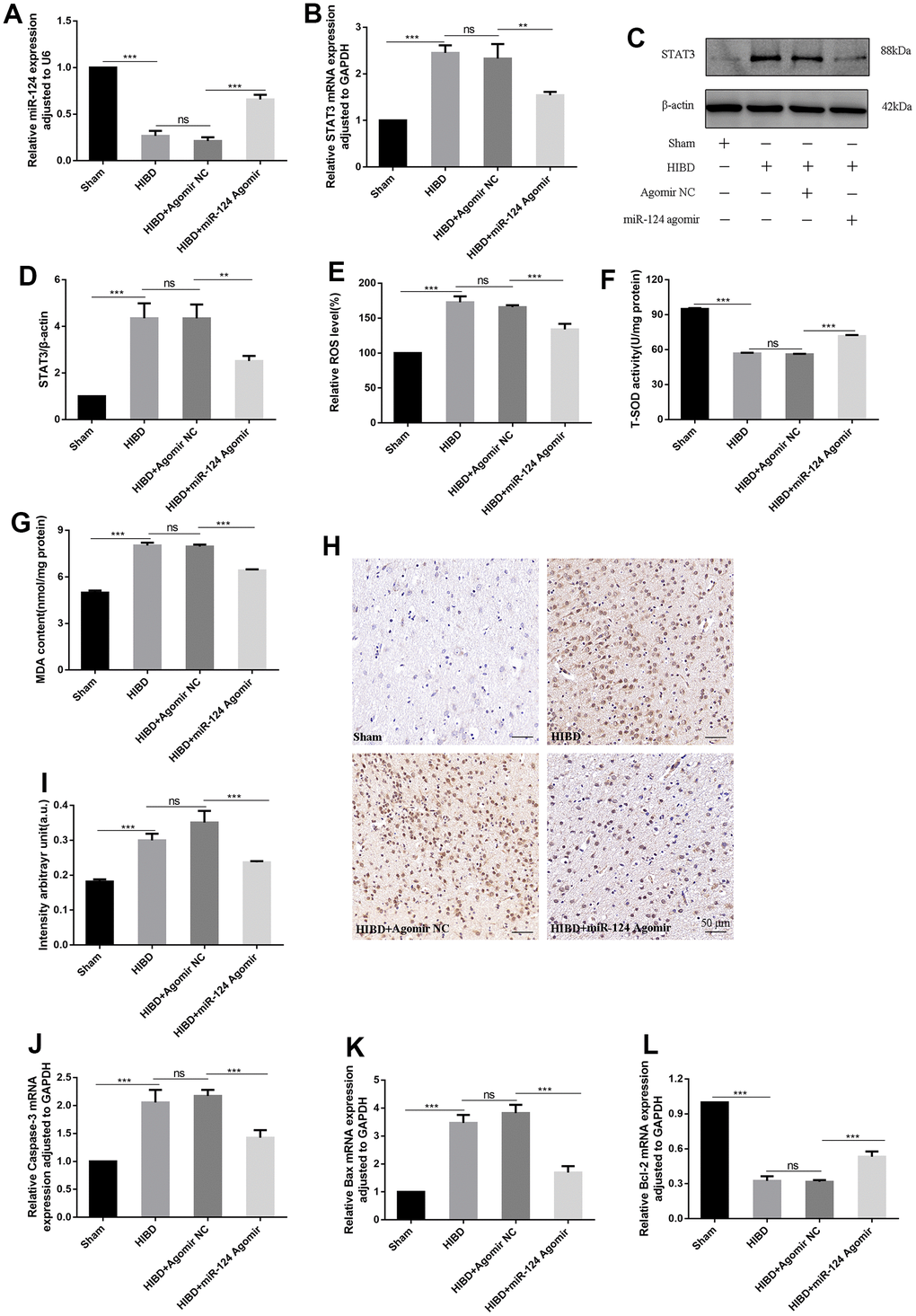 MiR-124 relieves oxidative stress and apoptosis in HIBD rats by inhibiting STAT3 in vivo. (A) The miR-124 was detected by qRT-PCR; (B) The STAT3 mRNA was detected by qRT-PCR; (C) The protein levels of STAT3 was detected by Western blot; (D) Quantitative analysis of the protein levels of STAT3; (E) The levels of intracellular ROS was measured; (F) The SOD activity was determined by the commercial kits; (G) The content of MDA was determined by the commercial kits; (H) Immunohistochemistry analysis of 8-OHdG intensity arbitrary in the peri-infarction cortex(number of animals: n=5/group). Scale bar, 50μm; (I) Quantitative analysis of protein levels of 8-OHdG by immunohistochemistry assay; (J–L) The mRNA levels of Caspase-3, Bax, and Bcl-2 were detected by qRT-PCR. Data were expressed as mean ± SD (number of animals: n =5/group); NS, not significant for p > 0.05, * p p p 