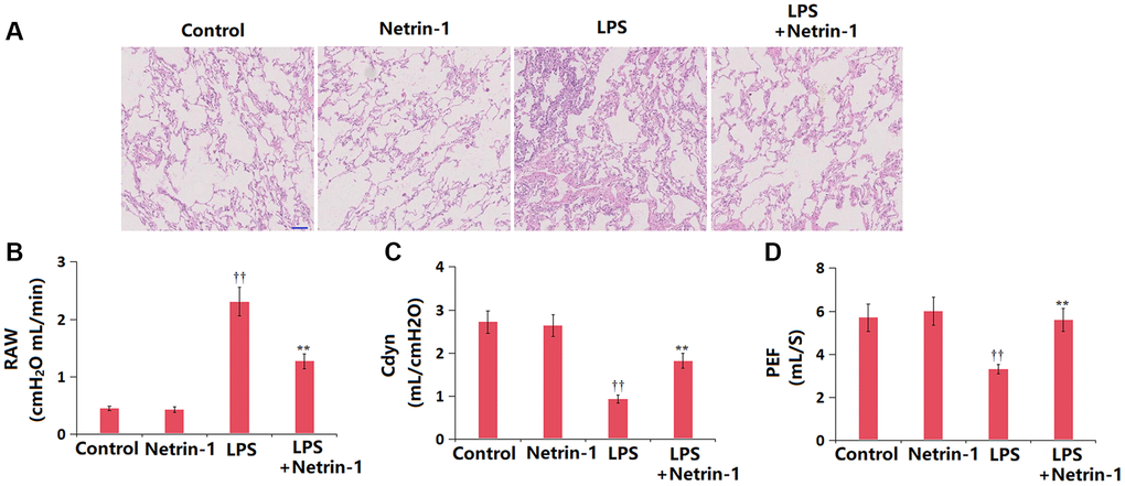 Netrin-1 improved histopathological changes and lung function in lung tissues in LPS- challenged ALI mice. (A). Histopathological changes of the lung tissue; Scale bar, 100 μm; (B). RAW (cmH2O mL/min); (C). Cdyn (mL/cmH2O); (D). PEF (mL/S) (††P **P 