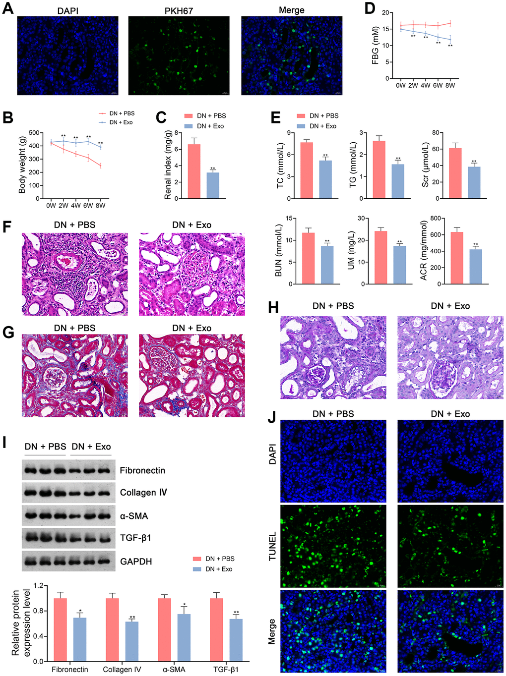 ADSC-derived Exos ameliorate the symptoms of DN in rats. (A) Determination of ADSC-derived Exos taken up by the kidney tissue cells of rats in each group using PKH67 staining. (B–D) The body weights, renal index, and FBG levels of rats in each group. (E) Plasma TC TG, Scr, BUN, UM, and ACR of rats in each group using enzymatic colorimetric assay and ELISA. (F–H) Histopathological examinations in the kidney tissues of rats in each group using HE, Masson, and PAS staining (scale bar = 20 μm). (I) The expression of fibronectin, collagen IV, α-SMA, and TGF-β1 in the kidney tissues of rats in each group using western blotting. (J) Cell apoptosis in the kidney tissues of rats in each group using TUNEL assay (scale bar = 20 μm). To explore the therapeutical effects of ADSC-derived Exos on DN, rats were subjected to caudal vein injection with Exos (1.6 mg/kg) for eight successive weeks. Rats treated with the same volume of PBS served as controls. Data were expressed as mean ± standard deviation (n = 6/group). *p **p 