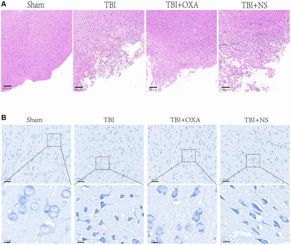 OXA can alleviate brain tissue damage after TBI. (A) Typical HE staining images of cortex in TBI rats of each group. (B) Representative Nissl stained images of cortex in TBI rats of each group.