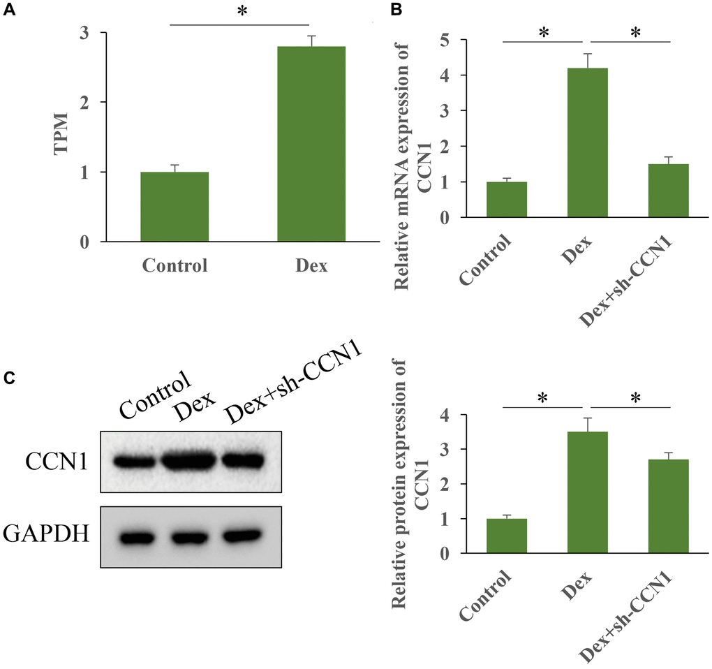 Dex greatly promoted the expression level of CCN1. (A) The level of CCN1 in HBMEC was measured with high throughput sequencing; (B) The level of CCN1 was measured with RT-PCR; (C) The level of CCN1 was measured with western blot. n = 3.
