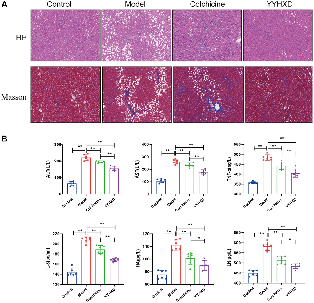 Effect of YYHXD on histological changes in CCl4 rats. (A) H&E staining (200X), Masson staining (200X) of rat livers. (B) Effect of YYHXD on level of inflammatory cytokines. Serum activities AST, ALT, IL6, TNF-α, HA and LN content. **P 