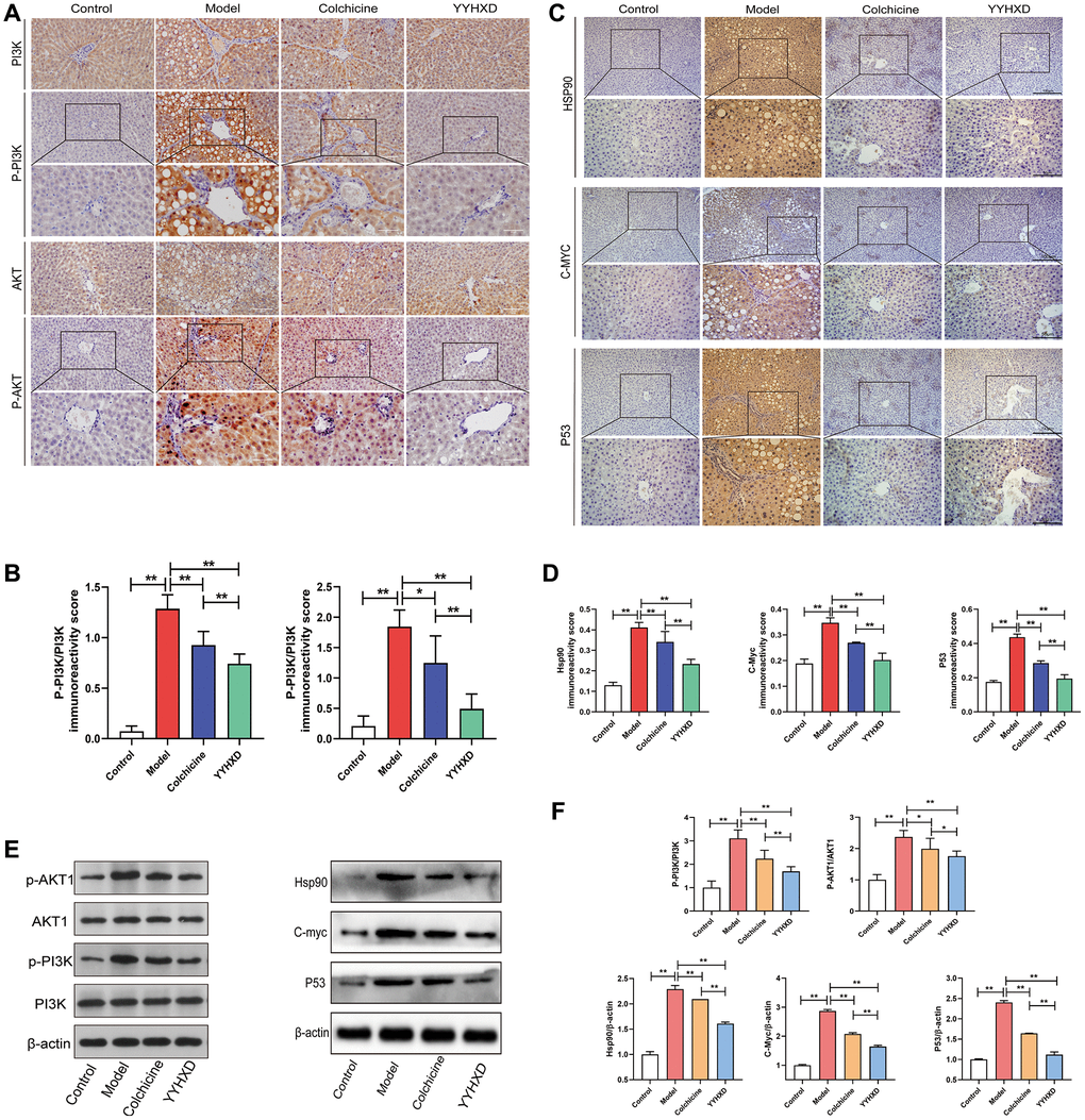 PI3K-AKT signaling pathways and molecular docking targets. (A, C) Immunohistochemical images showing P-PI3K, P-AKT1, HSP90, MYC, P53. Positive localization of protein in liver tissues. (B, D) Immunohistochemical positive expression rate. Expression rate. **P E, F) Western blot image showing P-PI3K, P-AKT1, HSP90, MYC, P53 expression in liver tissues. **P 