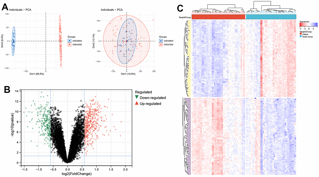 Principle components analysis (PCA) and analysis of differentially expressed genes (DEGs) between carotid atherosclerotic plaque and intact tissue samples. (A) PCA; (B) volcano plot; (C) heatmap of top 100 DEGs.