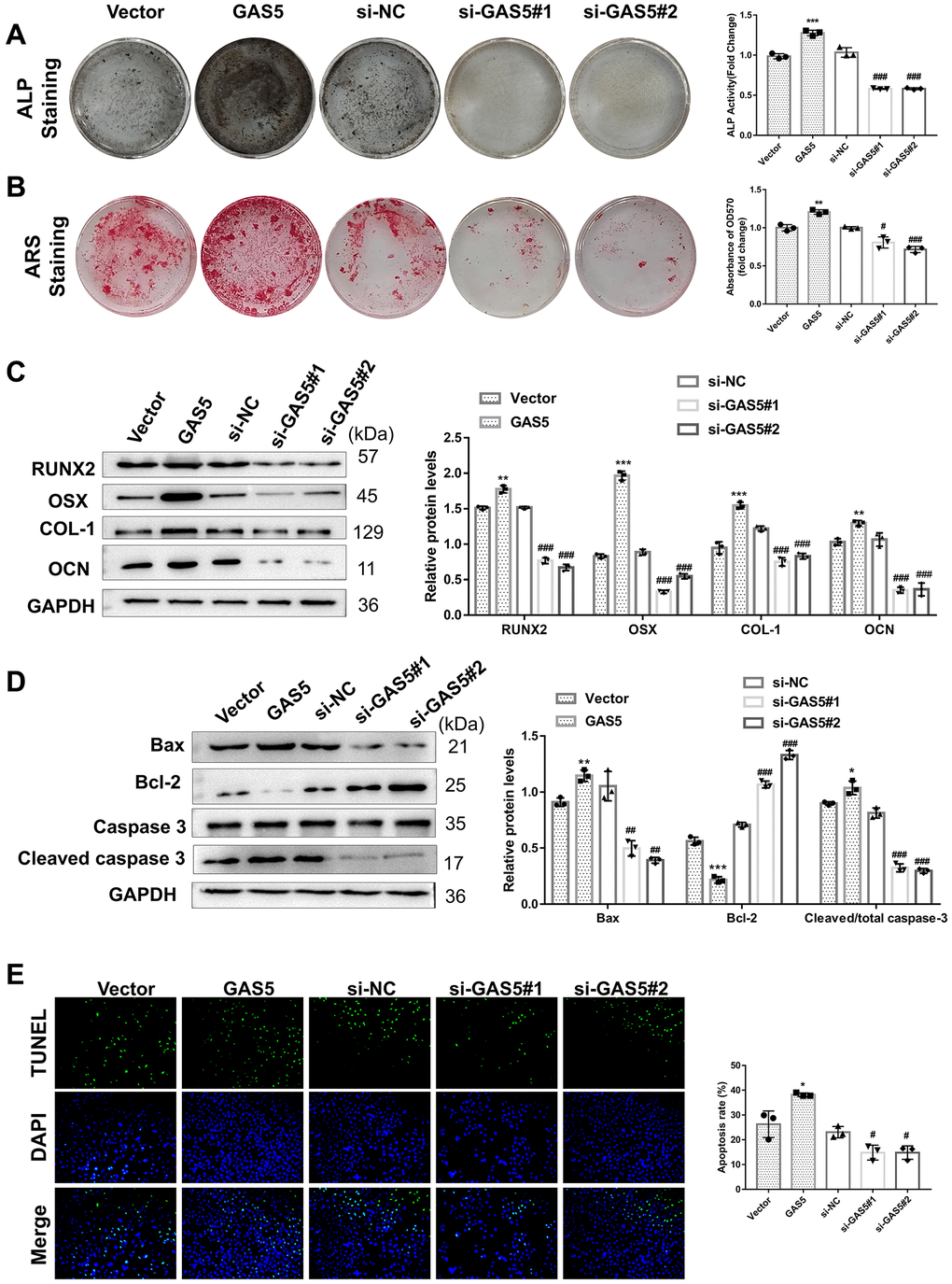 LncRNA GAS5 facilitates Afs apoptosis and osteogenic differentiation. AFs were transiently infected with the overexpression plasmid or GAS5 siRNA, while an empty vector and si-NC were used as negative controls. (A) The osteogenic differentiation-related markers were detected using a western blotting assay (n = 3). The osteogenic differentiation level of AFs with different transfections was evaluated by (B) ALP and (C) ARS assays. (n = 3) (D) The expressions of apoptosis-related proteins were detected by western blotting (n = 3). (E) TUNEL staining assay was performed to analyze the apoptosis of AFs (n = 3). (**p ***p #p ##p ###p 