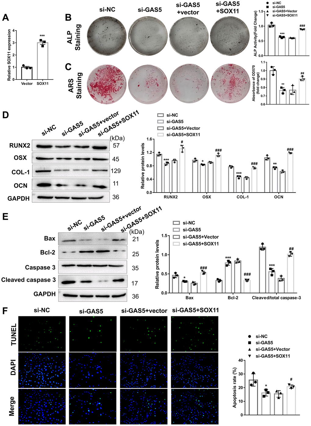 The role of GAS5 in the apoptosis and osteogenic differentiation of AFs was mediated by SOX11. (A) AFs were transfected with SOX11 overexpression or an empty vector, and the transfection efficacy was detected using qRT-PCR (n = 3). Next, AFs were transfected with or without si-GAS5 plasmid alone or with the SOX11 overexpression vector. (B) ALP and (C) ARS staining assays were used to evaluate the osteogenic differentiation level (n = 3). (D) The osteogenic differentiation-related markers were detected using western blotting (n = 3). (E) The apoptosis-related protein levels were measured using western blotting (n = 3). (F) TUNEL staining assay was employed to evaluate the apoptosis of AFs (n = 3). (*p **p ***p #p ##p ###p 
