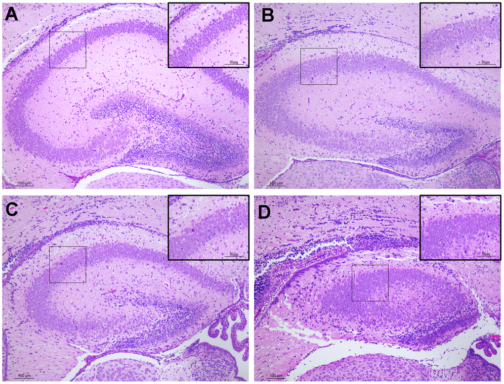 Histopathological changes in the hippocampus tissues of male offspring mice following pregnancy exposure to DEPs through hematoxylin and eosin (H&E) staining. 100 or 200 × magnification. (A) Control group. The morphology of hippocampus tissues was normal. (B–D) DEPs (0.235, 0.47 and 0.94 μg/mouse) treatment groups. Scale bar: 100 μm. N=4.