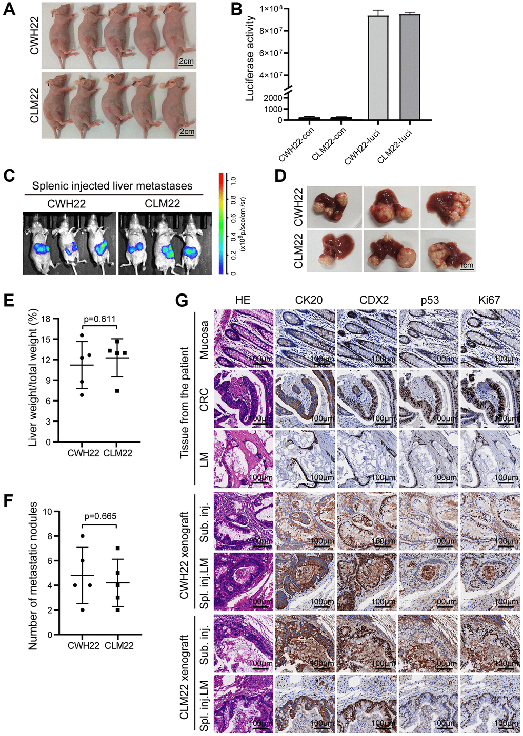 Tumorigenicity of CWH22 and CLM22 organoids in vivo. (A) Images of nude mice bearing CWH22 and CLM22 subcutaneous xenografts (scale bars, 2 cm). (B) Luciferase activity tests of CWH22-luci and CLM22-luci (CWH22 and CLM22 with no luciferase expression were tested as control). (C) Representative bioluminescence images of mice with liver metastases 42 days after splenic injection. (D) Representative pictures of livers with metastatic lesions (on day 45) harvested from mice receiving splenic injections of CWH22 and CLM22 organoid cells (scale bars, 1 cm). (E) Quantitative analysis of the percentage of tumor-bearing liver weight to body weight following splenic injection (n = 5; data represented as the mean ± SD). (F) Quantitative analysis of the metastatic nodule numbers per mouse following splenic injection (n = 5; data represented as the mean ± SD). (G) H&E morphology and IHC stains of tumor tissues from nude mice in A and B, as well as the normal mucosa and tumor tissues of the patient. Representative images of the expression of CK20, CDX2, Ki67, and p53 are shown (scale bars, 100 μm).