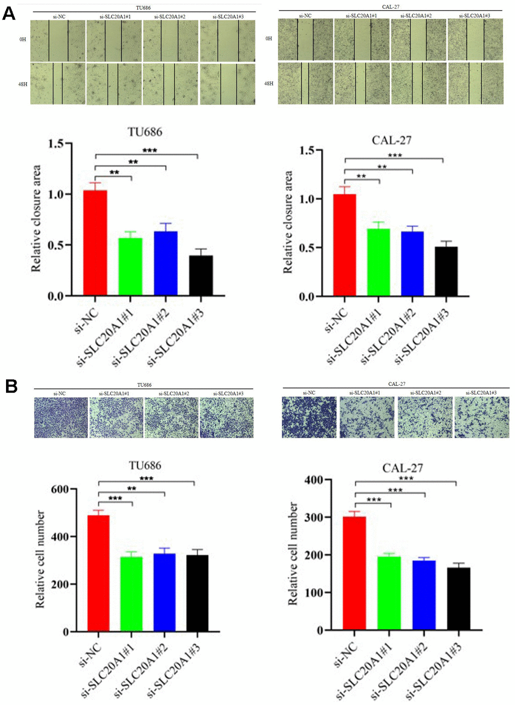 Silencing SLC20A1 inhibited migration and invasion in HNSCC. (A) Wound-healing experiments showed that silencing SLC20A1 inhibited cell migration. (B) Silencing SLC20A1 inhibited the ability to invade CAL-27 and TU686 cell lines. *, PPP