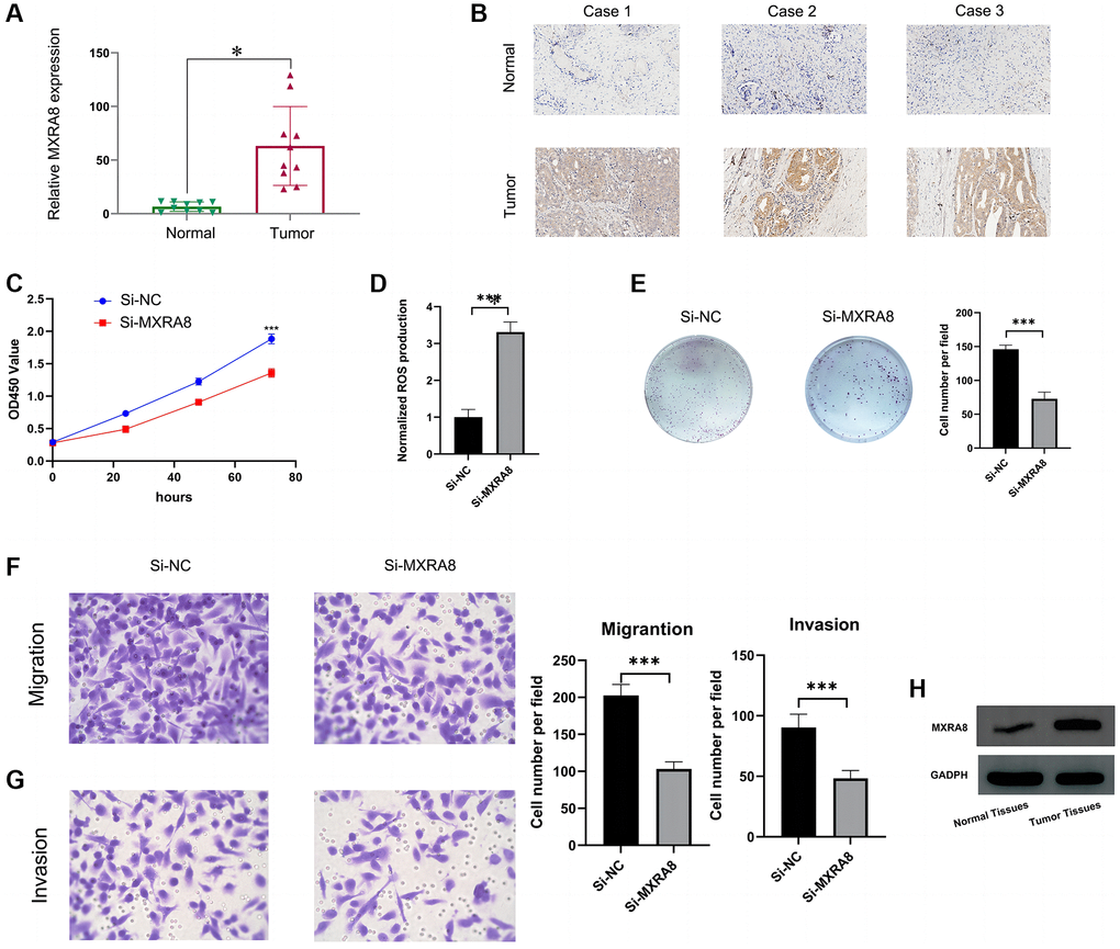 The role of MXRA8 in PC-3 cells. (A, B) PCR and immunohistochemistry results suggest that MXRA8 is highly expressed in prostate cancer tissues; (C) After knocking out MXRA8, the cell viability of PC-3 cells decreased; (D) After knocking out MXRA8, the ROS production ability of PC-3 cells increased; (E) After knocking out MXRA8, the proliferation ability of PC-3 cells decreased; (F, G) After knocking out MXRA8, the migration and invasion ability of PC-3 cells decreased; (H) The expression of MXRA8 in pancreatic cancer tissues was higher than that in normal tissues.