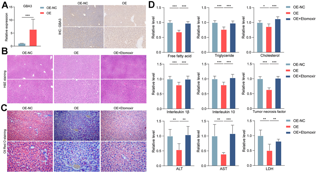 GBA3 protected rats from NAFLD. (A) Successful supplementation of GBA3 in the liver of mice was confirmed through PCR and immunohistochemistry. P-value was calculated by 2-tailed Student’s t test (***, P B) H&E staining of livers. (C) Oil Red O staining was used to assess lipid content. (D) Relative levels of free fatty acid, triglyceride, cholesterol, inflammatory factors, ALT, AST and LDH were detected in livers, P-value was calculated by 2-tailed Student’s t test (*, P 