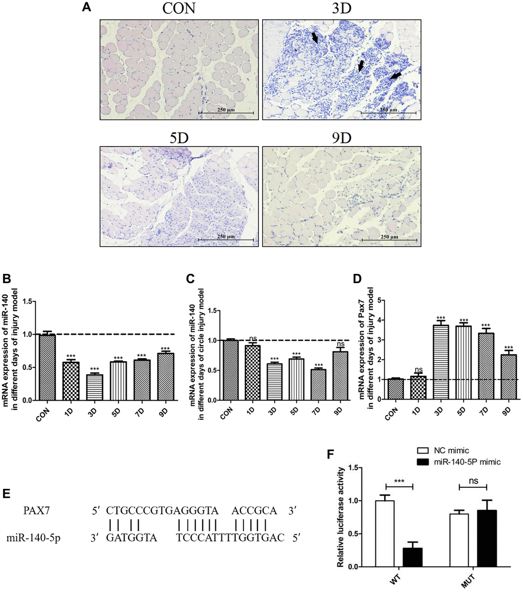 Significant downregulation of miR-140-5p expression following injury, contrasting with the expression trend of Pax7. Male wildtype C57BL/6 mice established damage model by intramuscular injection of 1.2% BaCl2 into the gastrocnemius muscle. (A) displays the muscle repair and regeneration process post-acute damage to the gastrocnemius muscle caused by BaCl2, as shown through histological examination staining (Scale bar in 250 μm). (B–D) present the RT-PCR results (fold change) illustrating the expression trends of miR-140-5p and Pax7 in the gastrocnemius muscle and circulation at different time points postinjury (n = 4 biological replicates). (E, F) demonstrate the binding pattern between miR-140-5p and Pax7, along with the dual luciferase assay results (n = 4), where WT refers to the wild type and MUT to the mutant type. The results are reported in the line/bar graph as mean ± SE; n = 4/group; different letters between bars mean P ≤ 0.05 analyses followed by non-paired Student’s t-test. *P **P ***P 