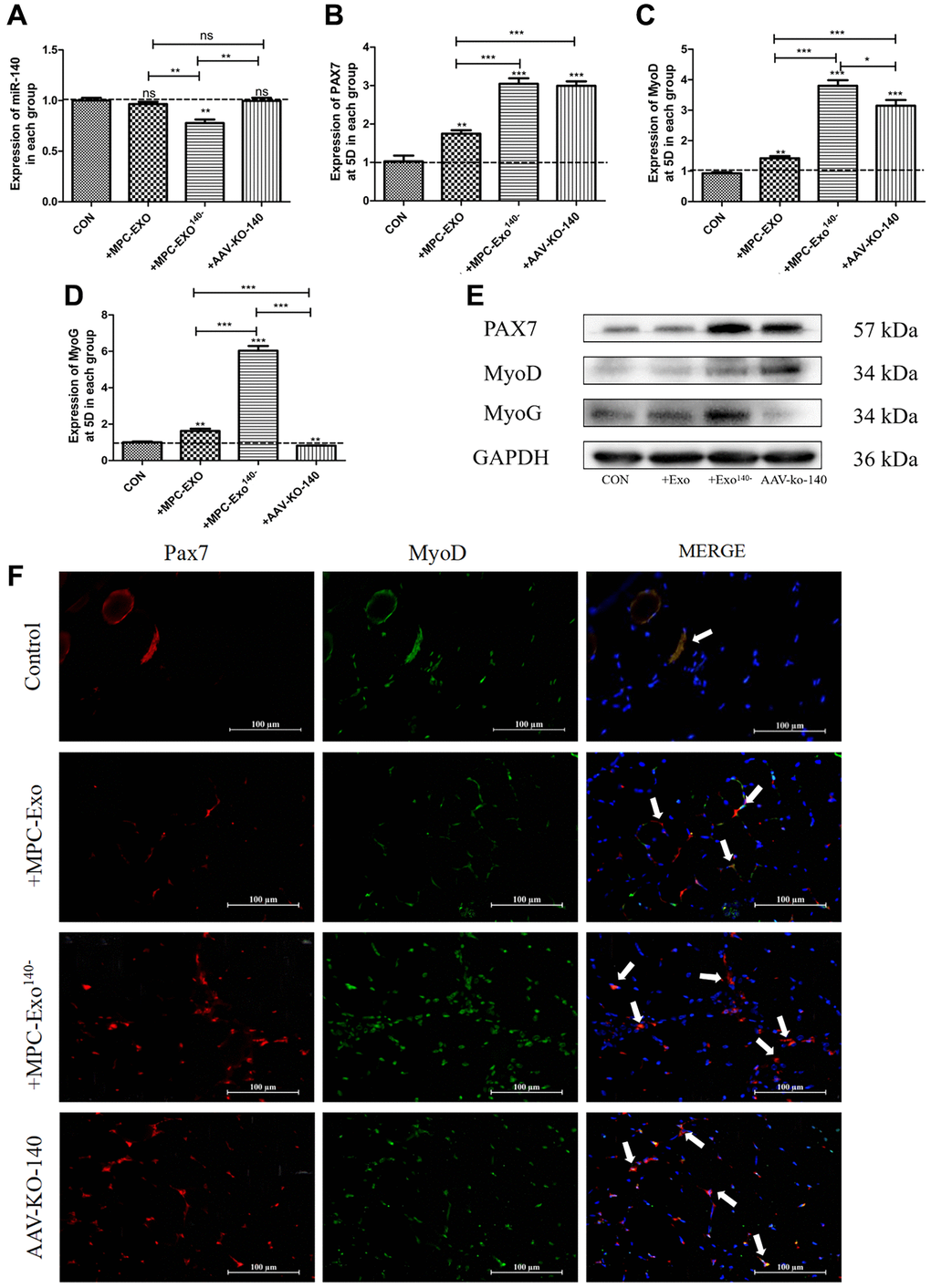 Muscle satellite cells in the gastrocnemius muscle activate by MPC-Exo, MPC-Exo140- or AAV-KO-140. Eight-week-old male wildtype C57BL/6 mice were treated with MPC-Exo and MPC-Exo140− 3 times. Five-week-old mice were injected with adeno-associated virus carrying miR-140-5p inhibitors. RT-qPCR was used to detect the expression (fold change) of miR-140-5p (A), Pax7 (B), MyoD (C) and MyoG (D). The amount of proteins for Pax 7, MyoD and myoD was analyzed by Western blot (E). Data: mean ± SEM (N = 5). *P F) presents the IF results: activated SCs are characterized by the coexpression of Pax7+/MyoD+. The marked locations in the figure indicate that in the control group, these cells are expressed only in the cell pool to maintain stem cell numbers. In the injected MPC-Exo group, there was a significant increase in activated SCs around the muscle fibers, indicating that muscle satellite cells were in a proliferative state. This proliferation of activated SCs was further augmented in the injected MPC-Exo140− group and AAV-KO-140 group (Scale bar in 100 μm).