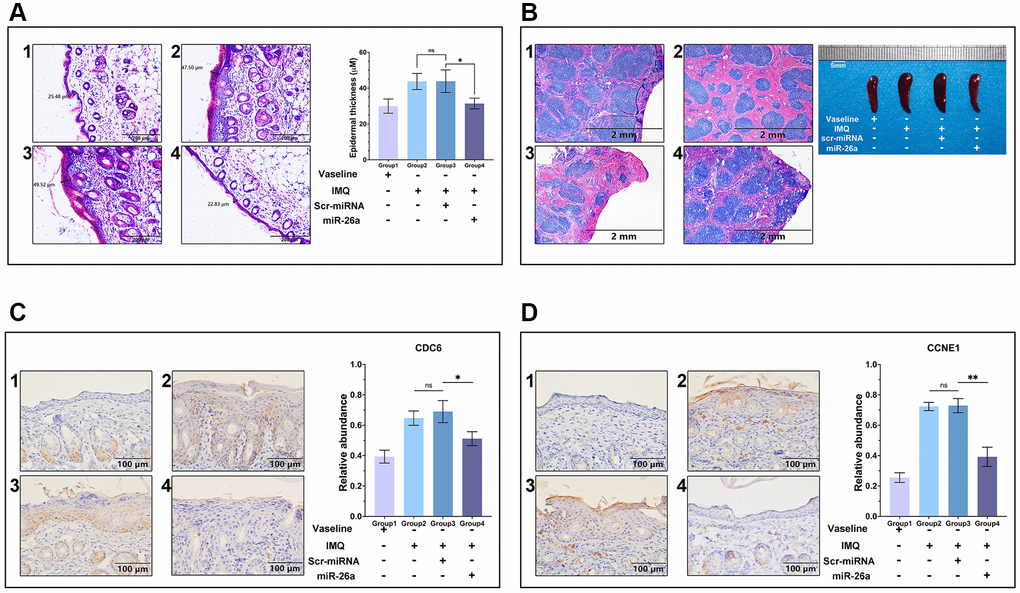 Histology and immunohistology of skin tissue and spleen sections. (A) H&E staining of paraffin sections of the dorsal skin and comparison of epidermal layer thickness. Scale bar: 200 μm. (B) Spleen sections and circumferential comparisons of mice from each group. Scale bar: 2 mm. (C, D) CCNE1 and CDC6 antibody staining of skin tissue sections for immunohistology analysis. Scale bar: 100 μm. The data are presented as the mean ± SD (n = 5). *p **p 