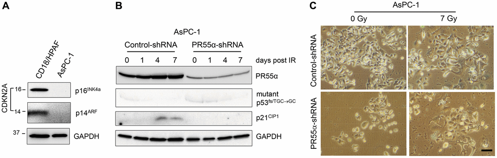 Knockdown of PR55α does not result in senescence induction by IR in pancreatic cancer cells that lack p16 expression. (A) The CDKN2A locus, which encodes the p16 and p14 genes, is deleted from AsPC-1 pancreatic cancer cells [37]. Log-phase growing AsPC-1 cells were analyzed for the presence of p16 and p14 proteins with CD18/HPAF pancreatic cancer cells as a positive control. (B) AsPC-1 cells stably transduced with the Dox-inducible PR55α-shRNA or Control-shRNA were induced with 2 μg/ml Dox for 3 days to knock down PR55α. The cells were then exposed to 7 Gy IR, or left unirradiated (0 time point), and incubated for an additional 1, 4 and 7 days. The cells were analyzed by immunoblotting for the levels of PR55α, p53, and p21. GAPDH level was measured as an internal loading control. (C) The irradiated cells incubated for 7 days were analyzed for senescence by SA-β-gal activity assay and photographed. Scale bar = 1 μm.