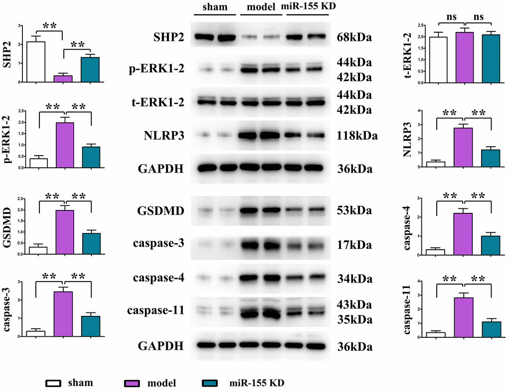Protein expression of SHP2, p-ERK1/2, t-ERK1/2, NLRP3, GSDMD, caspase-3, caspase-4, caspase-11 in cardiac tissue.