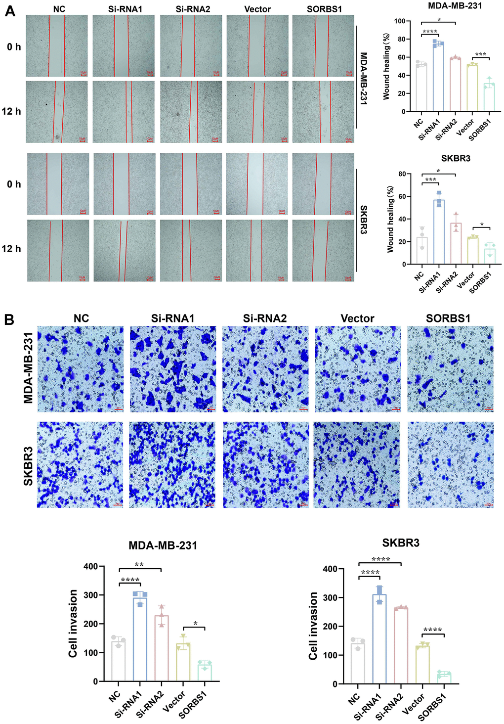 SORBS1 inhibits MDA-MB-231 and SKBR3 cell invasion and migration. MDA-MB-231 and SKBR3 cells were transfected with SORBS1 overexpression plasmid and siRNA for 48 h. (A) Changes in the migratory ability of MDA-MB-231 and SKBR3 cells were detected by scratch assay. (B) Changes in the invasive ability of MDA-MB-231 and SKBR3 cells were detected by transwell assay (*P **P ***P ****P 