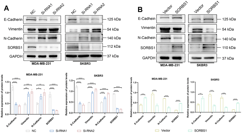 SORBS1 can regulate EMT-related proteins. (A) The expression of EMT-related proteins was detected 48 h after transfection of MDA-MB-231 cells with siRNA and overexpression plasmid of SORBS1. (B) The expression of EMT-related proteins was detected after transfecting SKBR3 cells with siRNA and overexpression plasmid of SORBS1 for 48 h. (*P **P ***P ****P 