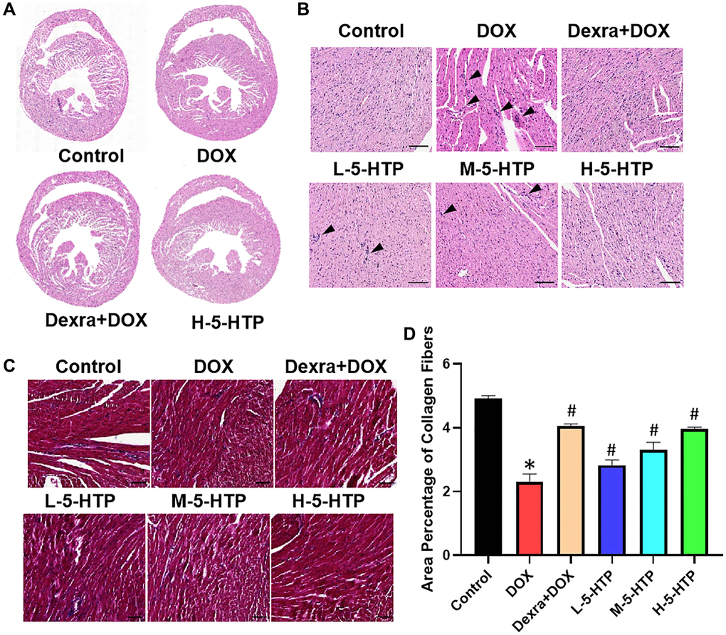 5-HTP ameliorates DOX-induced morphological damage of myocardial tissue in mice. (A) Scans of heart tissue sections; (B) The results from HE staining, bar = 100 μm; (C, D) The results and extent of fibrosis from MASSON staining, bar = 50 μm; *P #P 