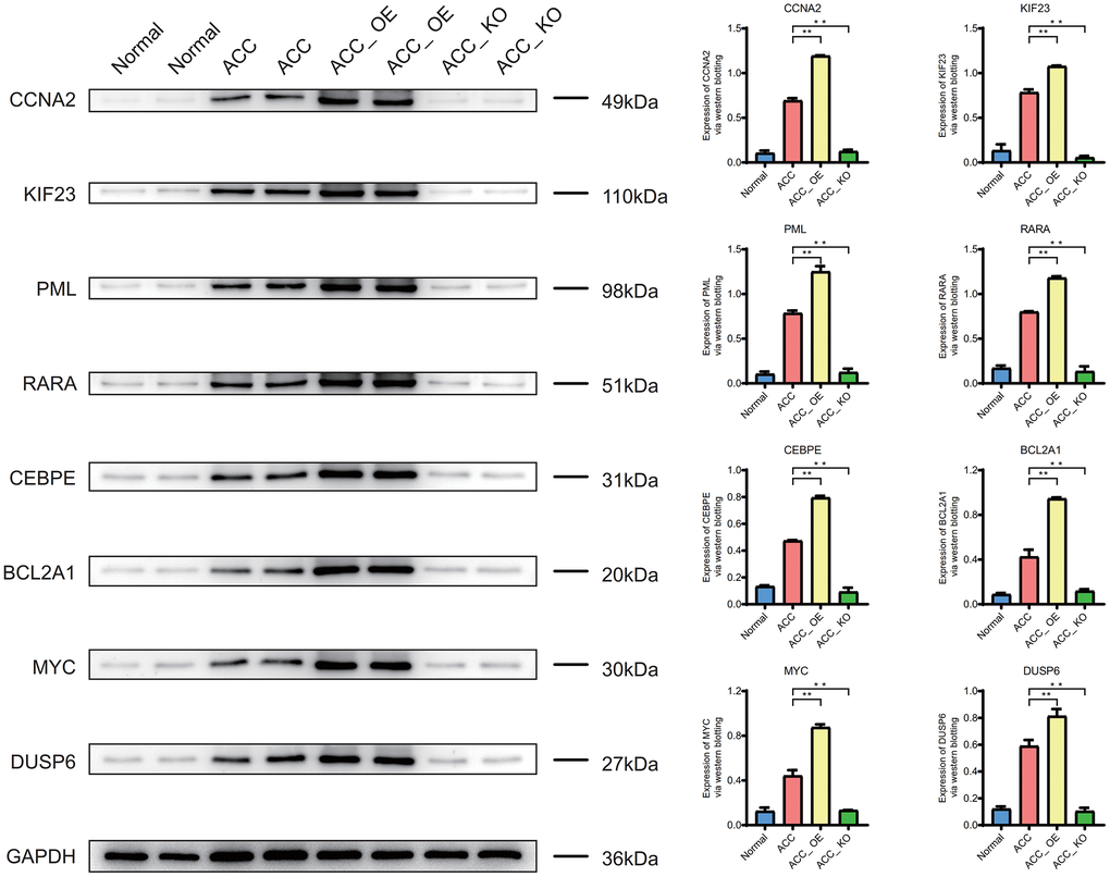 Western blotting. Expression of CCNA2, KIF23, PML, RARA, CEBPE, BCL2A1, MYC, and DUSP6 proteins in ACC group.
